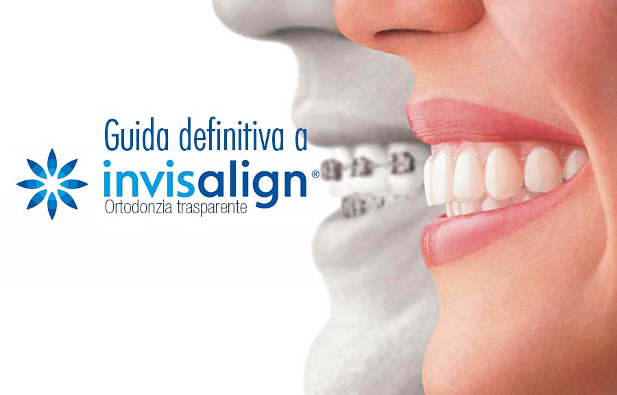 Invisalign - Ortodonzia invisibile