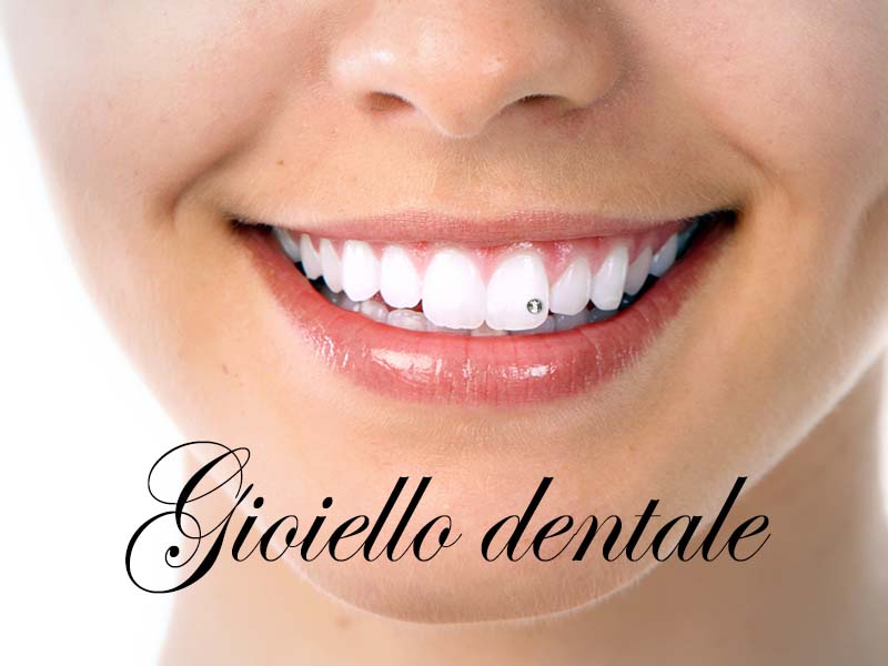 Brillantino al dente - DentistaDentista