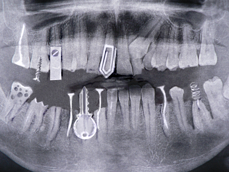 Il mio dentista mi lascia sempre a bocca aperta!