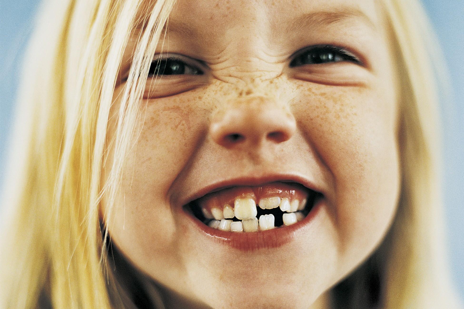 I bambini: i denti decidui o denti da latte