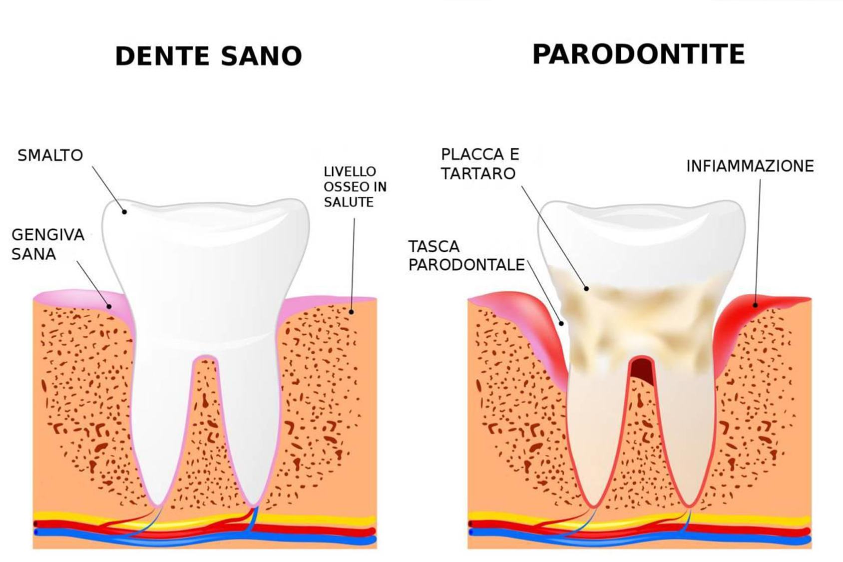 Bastano 6 denti per mettere a rischio la salute della bocca